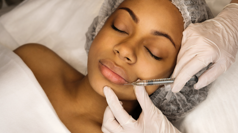 WhatAreDermalFillers