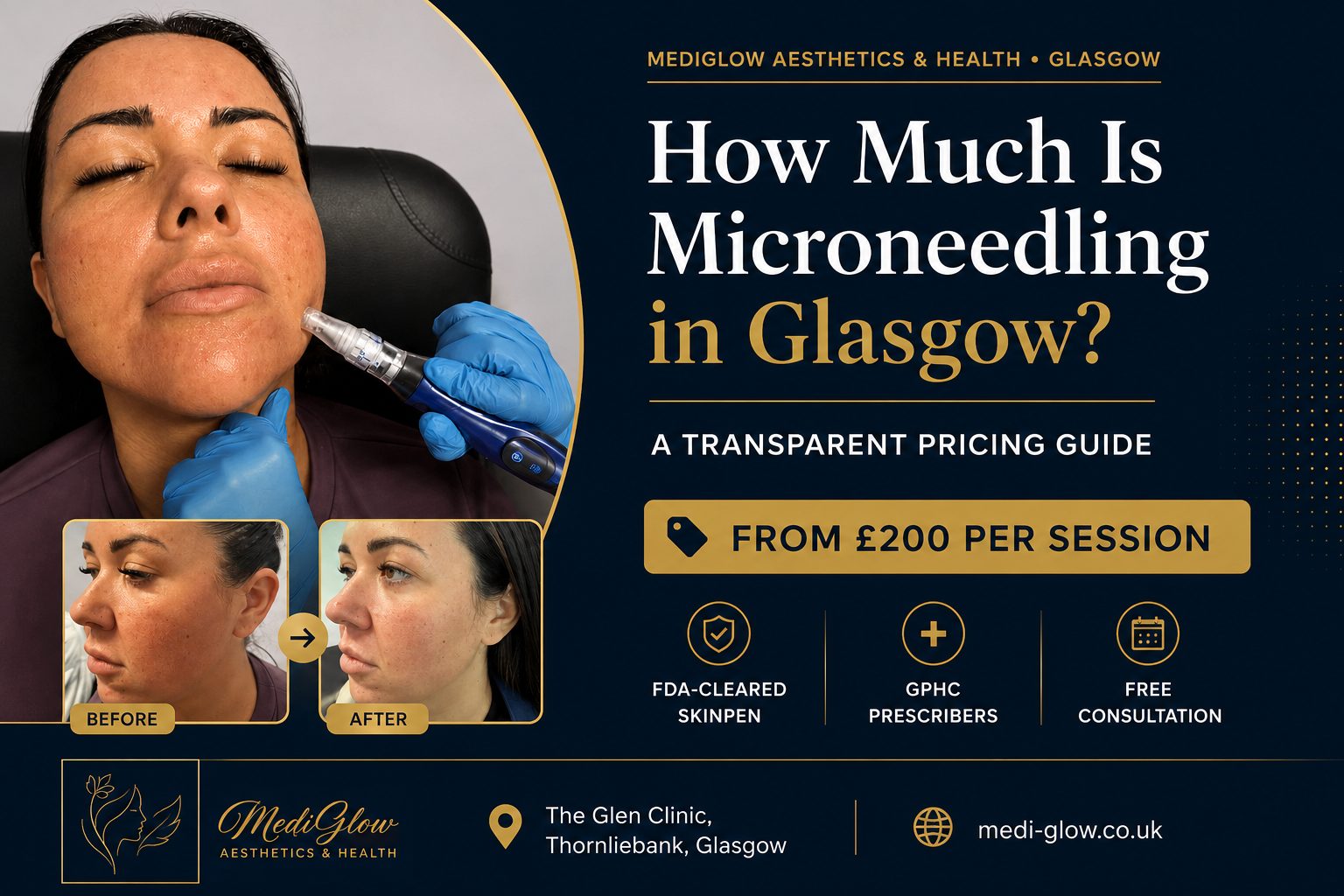 Microneedling treatment session in progress at MediGlow Aesthetics & Health, The Glen Clinic, Thornliebank, Glasgow - collagen induction therapy using a medical-grade microneedling device